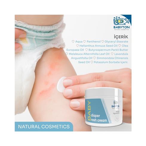 Babyton Pişik Önleyici Krem 50 Ml