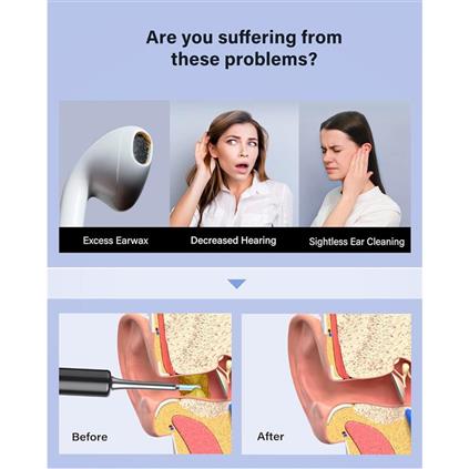 Bebırd T5 3MP Kamera 3.5MM Lens Şarjlı Wıfı Görüntülü Kulak Temizleyici Siyah Renk